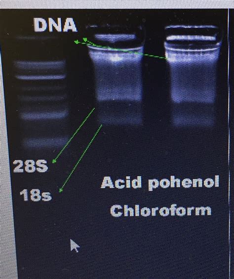 How Can I Determine If Genomic Dna Is Contaminated With Rna Researchgate