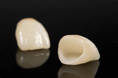 Full Ceramic Crowns Cosmetic Dentistry Dental Treatments Abroad