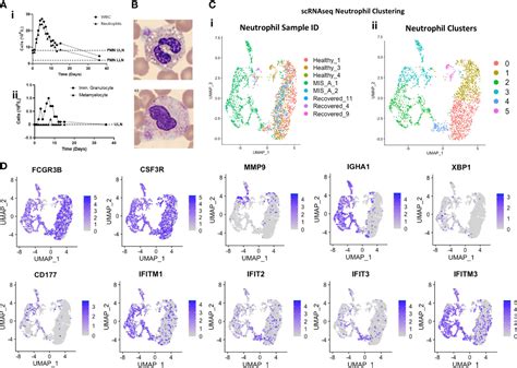 Frontiers Case Report Immune Profiling Links Neutrophil And