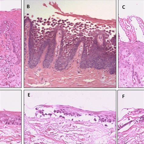 Pdf Tissue Engineered Oral Mucosa