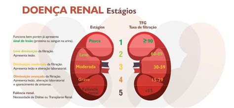 Est Gios Da Doen A Renal Cr Nica New Service