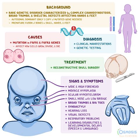 Pfeiffer Syndrome: What Is It, Causes, Signs and Symptoms | Osmosis