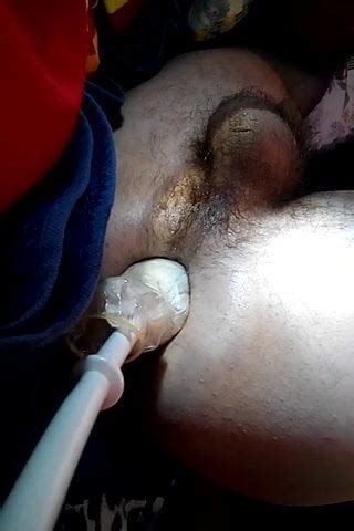 Anal Play Extrem Gay Porn Feat Analsau XHamster