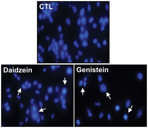 Antiproliferative Activity Of Daidzein And Genistein May Be Related To