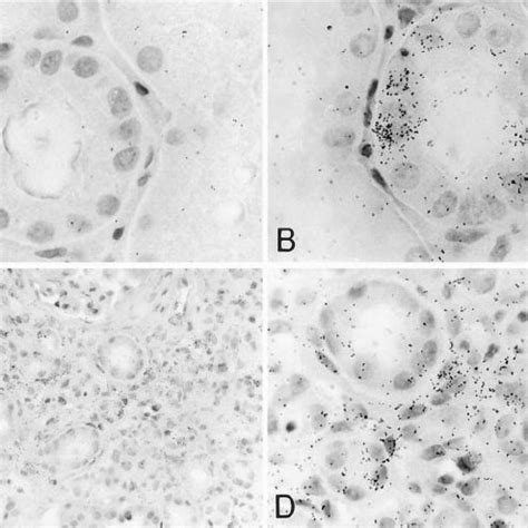 Monocyte Chemoattractant Protein Mcp Mrna Expression In The