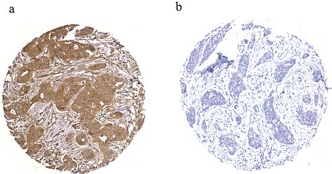 Full Article The Amino Acid Transporter Slc A Expression In Breast