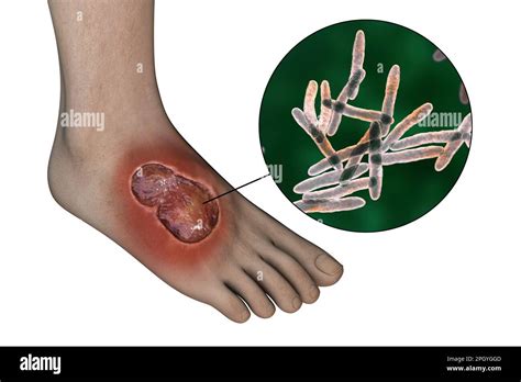 Patología médica Imágenes recortadas de stock Alamy