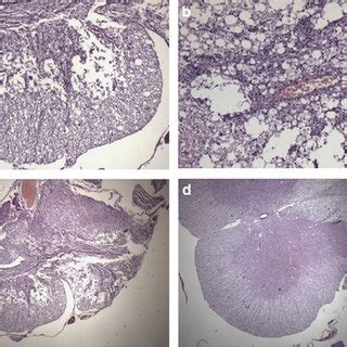 Histological Evaluation With Hematoxylineosin Staining A Intense