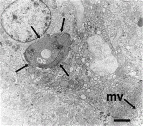 Hexamita Meleagridis Spironucleus Meleagridis Infection In Chukar Partridges Associated With