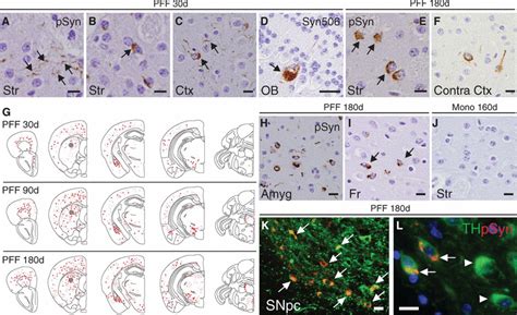 Pathological α Synuclein Transmission Initiates Parkinson like