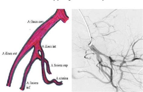 Uterine Artery Anatomy