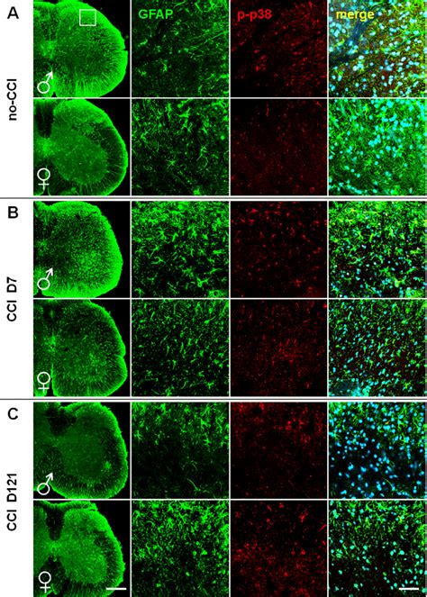 Sex Dependent Differences In The Expressionactivation Of Astrocytes At