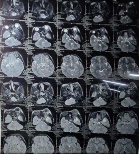 Ct Scan Of The Patient Download Scientific Diagram