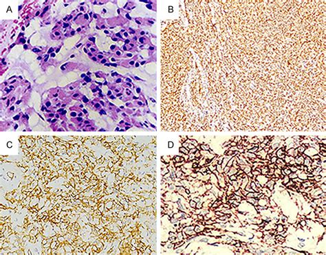 Histopathological Examination Of The Resected Specimen Download Scientific Diagram