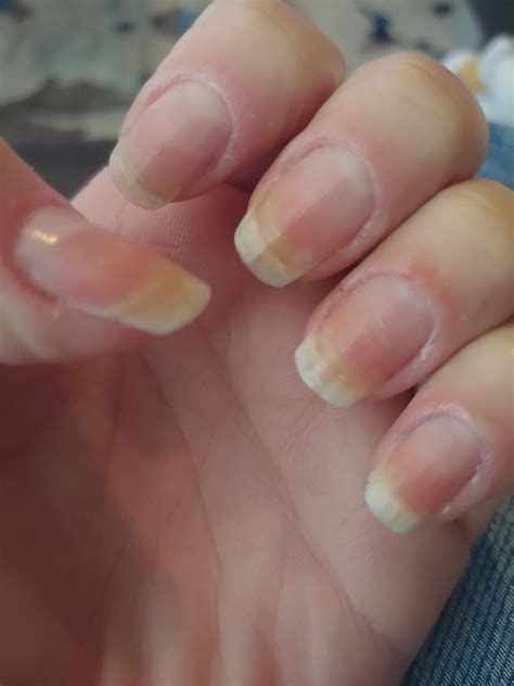 2 Months Of Growth My Nails Look Yellow Because I Have Kept Them