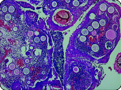 Photomicrograph showing numerous sporangia in different phases of ...