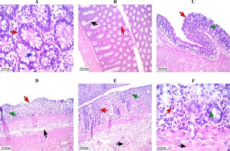 Histopathological Assessment Of Normal Control And DSS Induced Chronic