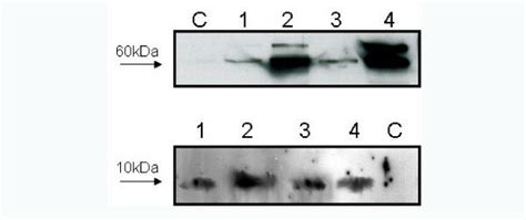 Western Blot Analyses For The Research Of Hsp60 And Hsp10 In Tissue