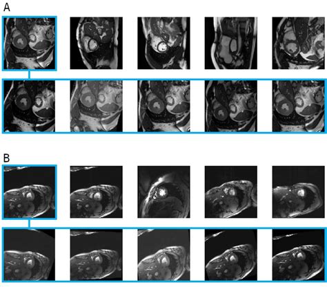 Figure 3 From A Deep Learning Based Cardiac Cine Segmentation Framework