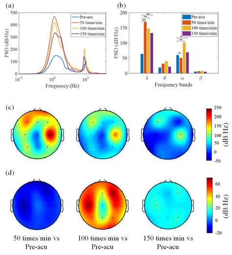 Brain Electrical Activity Mapping Beam The Best Picture Of Beam