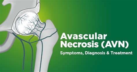 Avascular Necrosis Symptoms