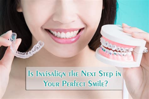 Is Invisalign The Next Step In Your Perfect Smile Hamburg Dental Care