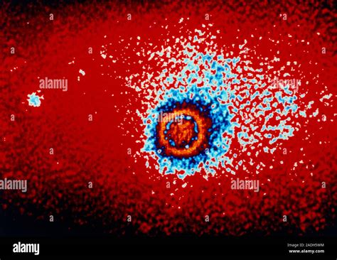 Rhinoviruses. Coloured transmission electron micrograph (TEM) of a ...