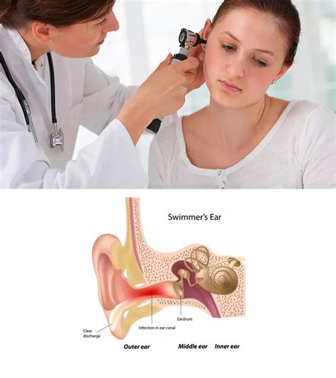 10 Symptoms Of Ear Infection In Teens Causes And Treatment