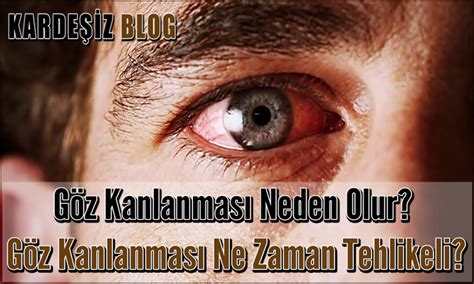 G Z Kanlanmas Neden Olur G Z Kanlanmas Ne Zaman Tehlikeli