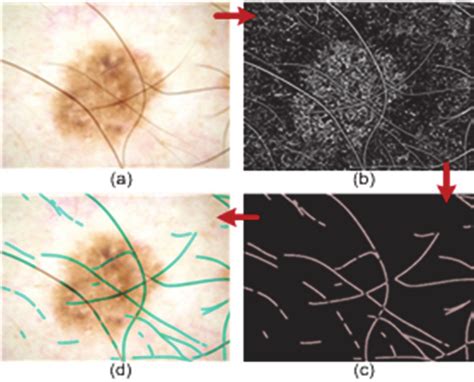 A Original Image B Perona Malik Anisotropic Diffusion C Hair