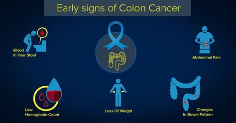 5 Early Signs That Shout Colon Cancer