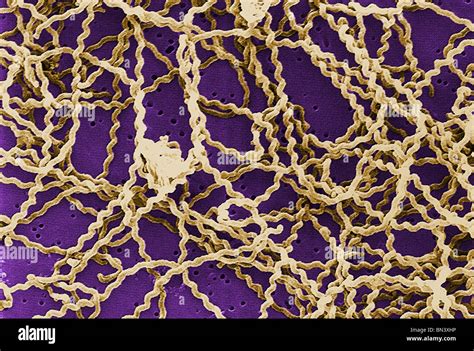 An Lisis Micrograf A De Electrones Sem De La Bacteria Leptospira Sp