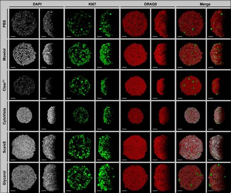 Frontiers Routine Optical Clearing Of D Cell Cultures Simplicity