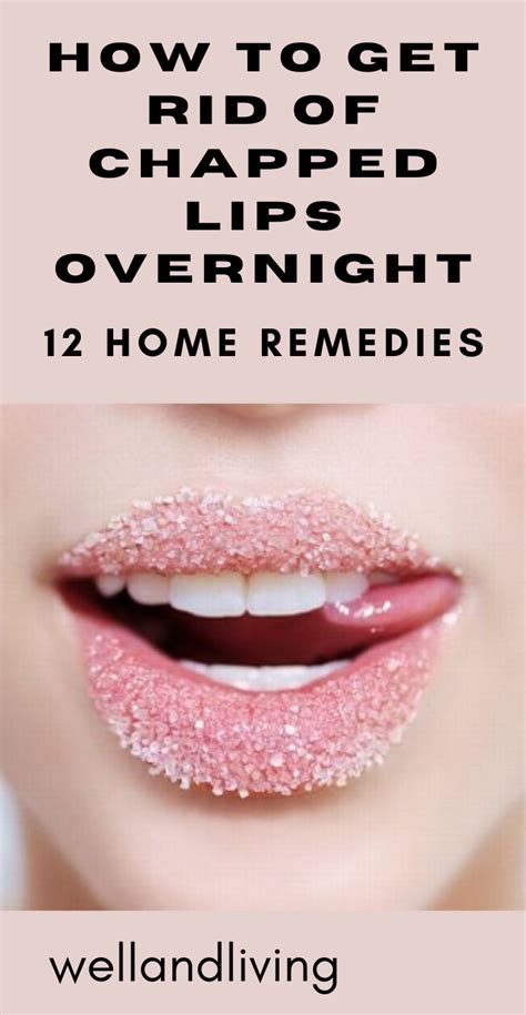 12 Home Remedies To Get Rid Of Chapped Lips Overnight Saayla