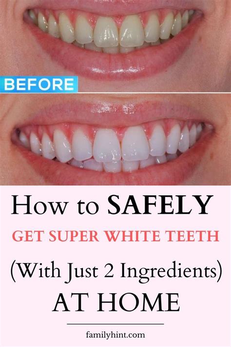 How To Whiten Teeth At Home Fast With This 1 Effective Method Artofit