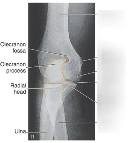 Elbow Radiograph Anatomy Diagram Quizlet