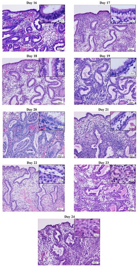 Endometrial Dating Method Detects Individual Maturation Sequences