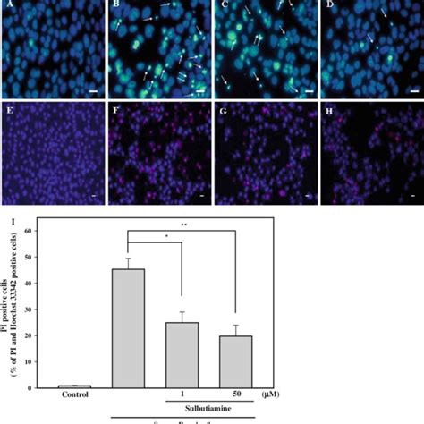 Anti Apoptotic Effect Of Sulbutiamine On Rgc 5 Cells Incubated In Serum