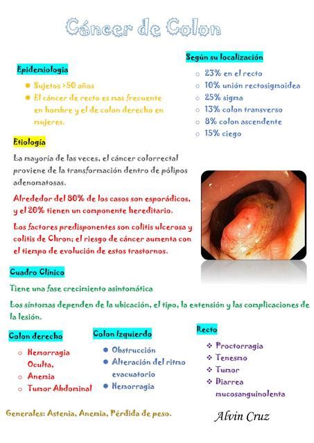 Cancer De Colon Salud Res Menes De Medicina Udocz