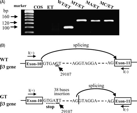 Glanzmann S Thrombasthenia Due To A Point Mutation Within Intron 10