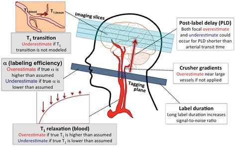 Comparison of cerebral blood flow measurement with [15O]-water positron ...