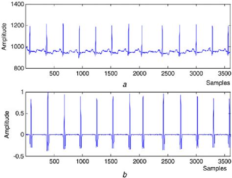 Plot of ECG signal before and after filtering a Input ECG signal b ECG ...