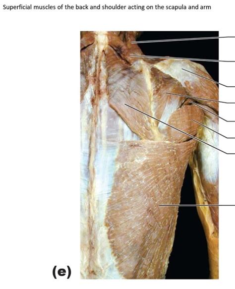 Cadaver Back Muscles And Bones Diagram Quizlet