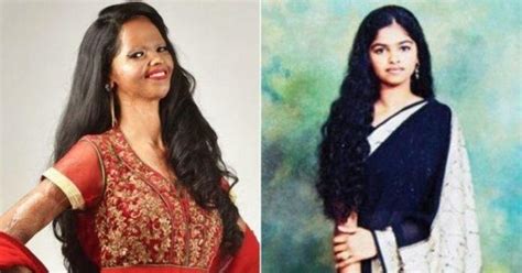 Chhapaak: When 32-year-old Naeem Khan threw acid on 15-year-old Laxmi's ...