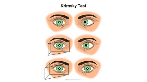 Krimsky Test Atlas Der Augenheilkunde