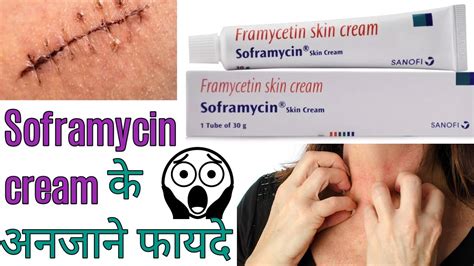 Framycetin Skin Cream Soframycin Skin Cream Youtube