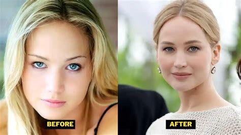 Jennifer Lawrence Plastic Surgery Teeth Before Veneers Weight Loss