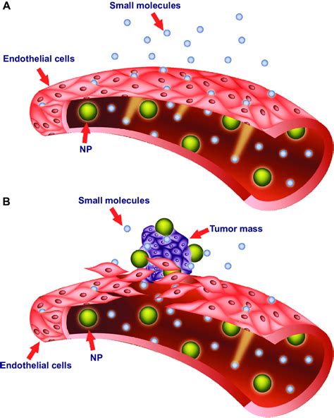 Targeting Of Nanomedicines By The Enhanced Permeability And Retention