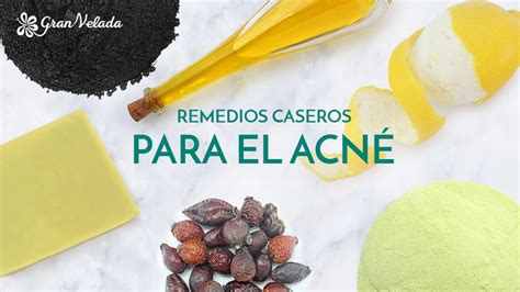 Introducir 97 Imagen Recetas Naturales Para Acne Abzlocal Mx