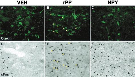 Orexin Neurons And C Fos Expression After Intra Lha Injections Of